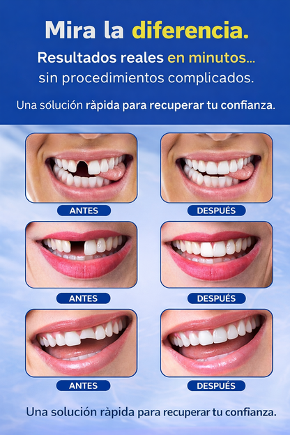 dentix- resina moldeable (hasta 30 dientes)