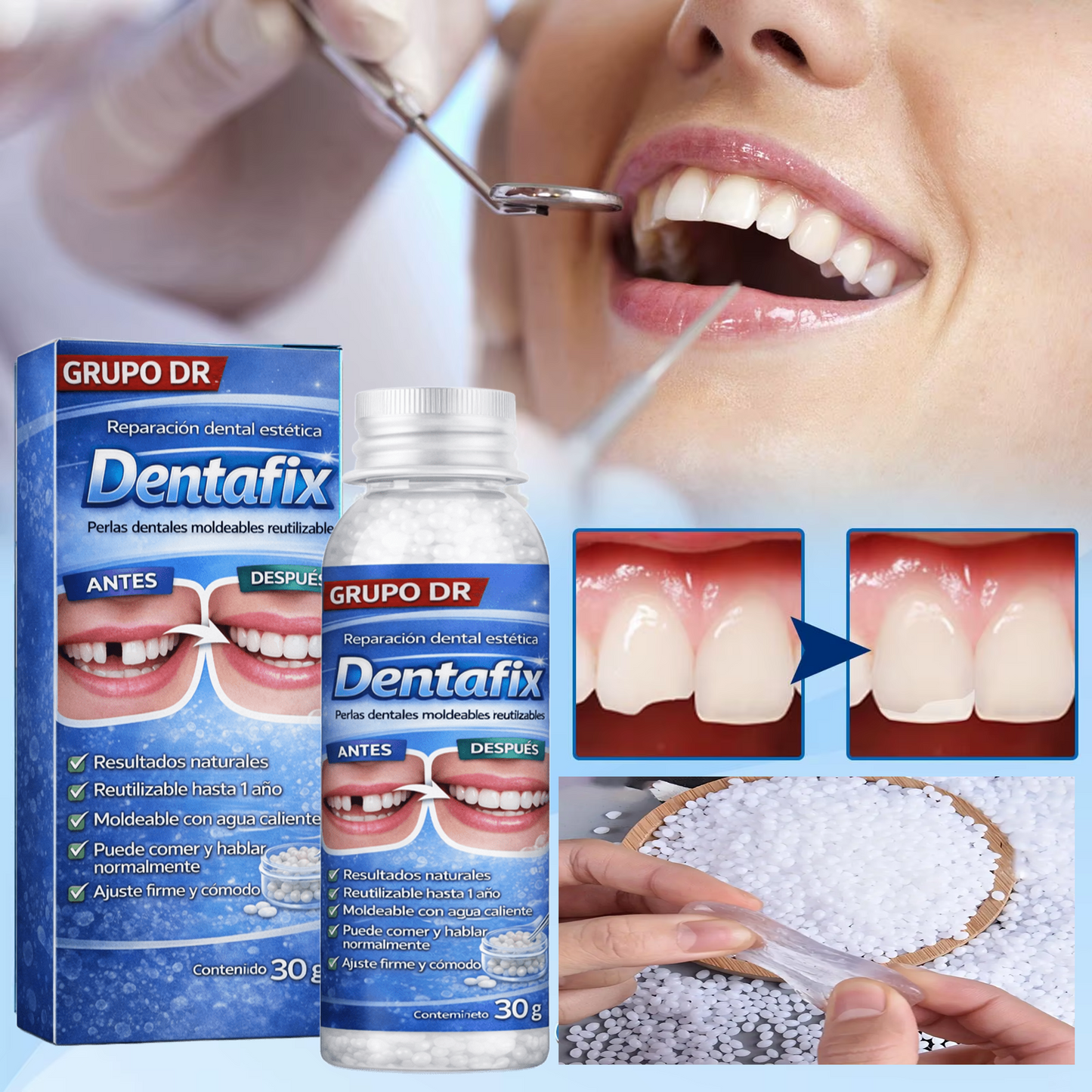 dentix- resina moldeable (hasta 30 dientes)